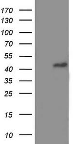 TRIM54 Antibody in Western Blot (WB)