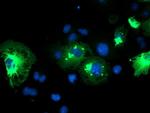 TRIM9 Antibody in Immunocytochemistry (ICC/IF)