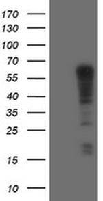 TRIM9 Antibody in Western Blot (WB)