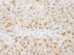 TRIP1/SUG1 Antibody in Immunohistochemistry (IHC)