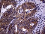 TRIP13 Antibody in Immunohistochemistry (Paraffin) (IHC (P))