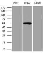 TRIP13 Antibody in Western Blot (WB)