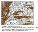 TrkA Antibody in Immunohistochemistry (IHC)