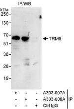 TRM6 Antibody in Immunoprecipitation (IP)