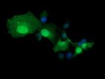 TRMT2A Antibody in Immunocytochemistry (ICC/IF)