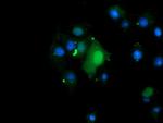 TRMT2A Antibody in Immunocytochemistry (ICC/IF)