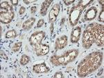 TRMT2A Antibody in Immunohistochemistry (Paraffin) (IHC (P))