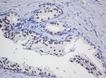 TRMT2A Antibody in Immunohistochemistry (Paraffin) (IHC (P))