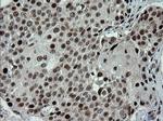 TRMT2A Antibody in Immunohistochemistry (Paraffin) (IHC (P))