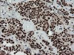 TRMT2A Antibody in Immunohistochemistry (Paraffin) (IHC (P))