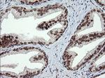 TRMT2A Antibody in Immunohistochemistry (Paraffin) (IHC (P))