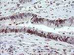 TRMT2A Antibody in Immunohistochemistry (Paraffin) (IHC (P))