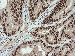 TRMT2A Antibody in Immunohistochemistry (Paraffin) (IHC (P))