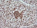 TRMT2A Antibody in Immunohistochemistry (Paraffin) (IHC (P))