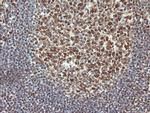 TRMT2A Antibody in Immunohistochemistry (Paraffin) (IHC (P))