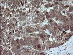 TRMT2A Antibody in Immunohistochemistry (Paraffin) (IHC (P))