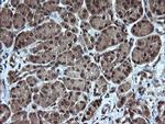 TRMT2A Antibody in Immunohistochemistry (Paraffin) (IHC (P))