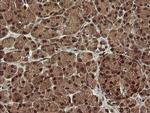 TRMT2A Antibody in Immunohistochemistry (Paraffin) (IHC (P))