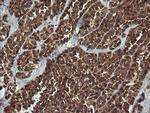 TRMT2A Antibody in Immunohistochemistry (Paraffin) (IHC (P))