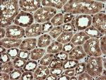 TRMT2A Antibody in Immunohistochemistry (Paraffin) (IHC (P))