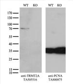 TRMT2A Antibody