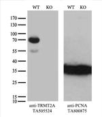 TRMT2A Antibody