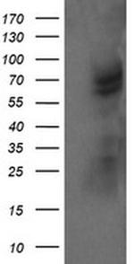 TRMT2A Antibody in Western Blot (WB)