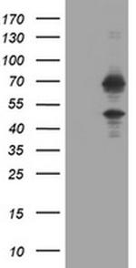 TRMT2A Antibody in Western Blot (WB)