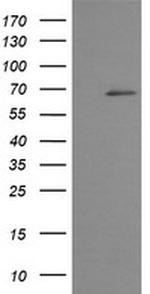 TRMT2A Antibody in Western Blot (WB)