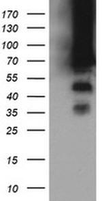 TRMT2A Antibody in Western Blot (WB)