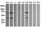 TRMT2A Antibody in Western Blot (WB)