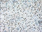 TRPM4 Antibody in Immunohistochemistry (Paraffin) (IHC (P))