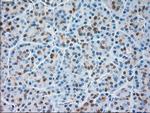 TRPM4 Antibody in Immunohistochemistry (Paraffin) (IHC (P))