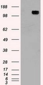 TRPM4 Antibody in Western Blot (WB)