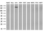 TRPM4 Antibody in Western Blot (WB)