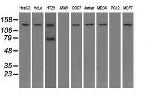 TRPM4 Antibody in Western Blot (WB)