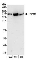 TRPM7 Antibody in Western Blot (WB)