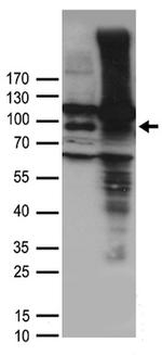 TRPV1 Antibody in Western Blot (WB)