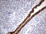 TSC1 Antibody in Immunohistochemistry (Paraffin) (IHC (P))