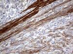 TSC1 Antibody in Immunohistochemistry (Paraffin) (IHC (P))