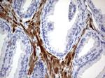 TSC1 Antibody in Immunohistochemistry (Paraffin) (IHC (P))