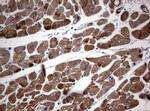 TSC1 Antibody in Immunohistochemistry (Paraffin) (IHC (P))