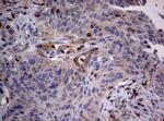 TSC1 Antibody in Immunohistochemistry (Paraffin) (IHC (P))