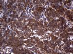 TSC1 Antibody in Immunohistochemistry (Paraffin) (IHC (P))