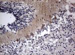 TSC1 Antibody in Immunohistochemistry (Paraffin) (IHC (P))