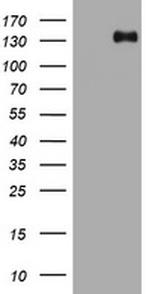 TSC1 Antibody in Western Blot (WB)