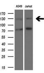 TSC1 Antibody in Western Blot (WB)