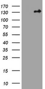 TSC1 Antibody in Western Blot (WB)