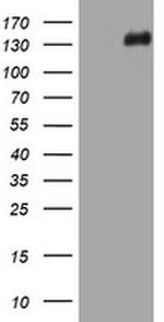 TSC1 Antibody in Western Blot (WB)