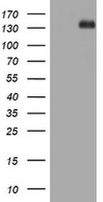 TSC1 Antibody in Western Blot (WB)